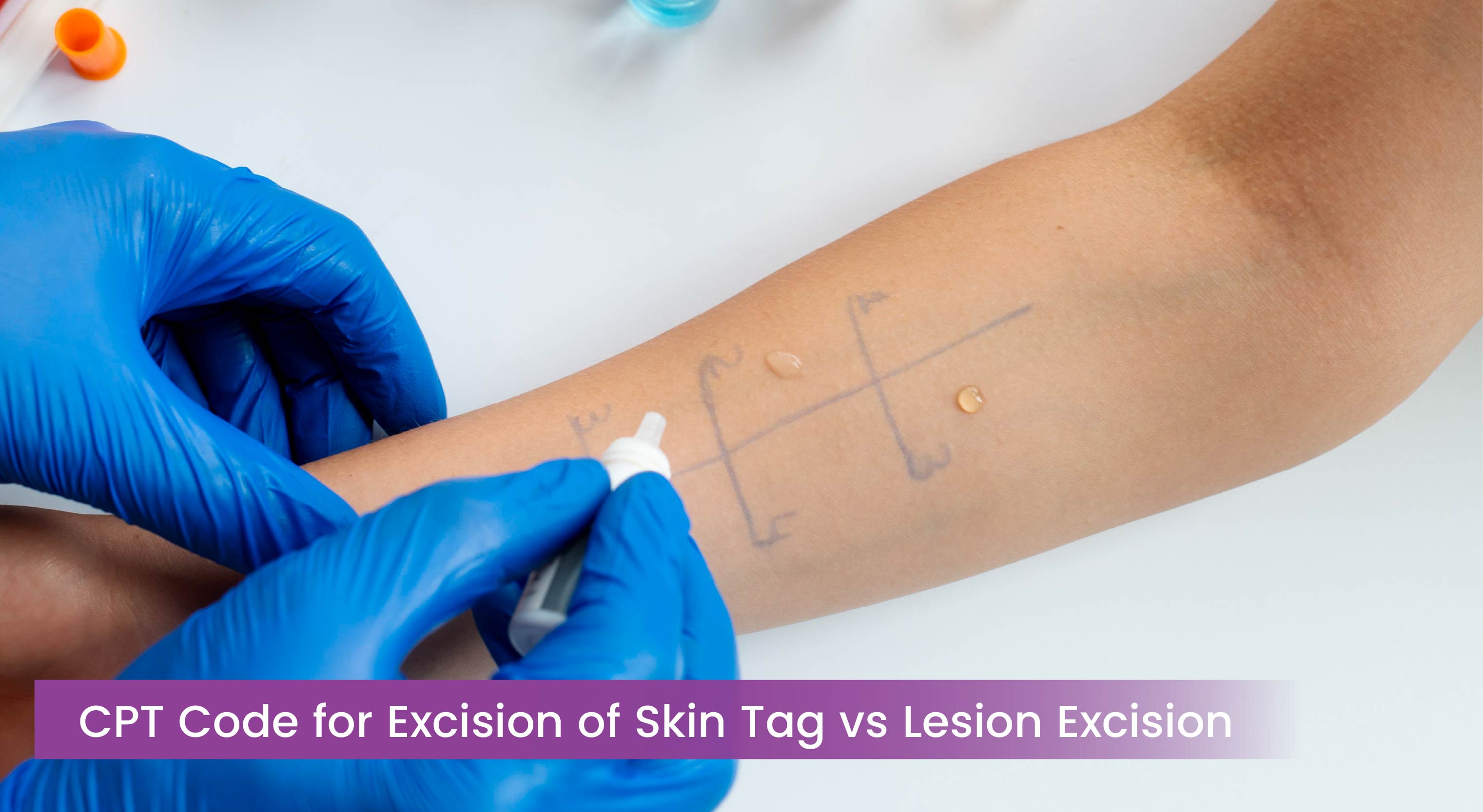 CPT Code for Excision of Skin Tag vs Lesion Excision